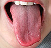 Foto: Minnesotaherbalist